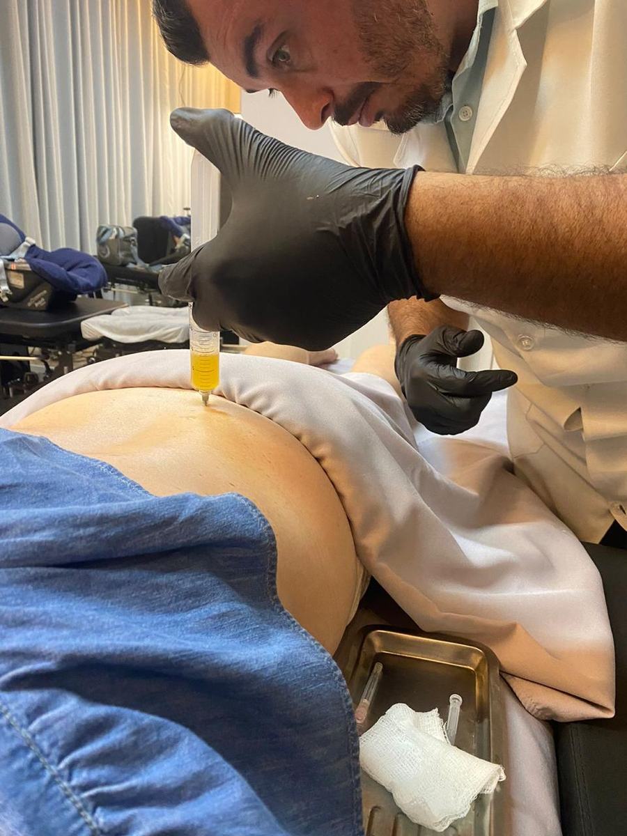 Dr. Luis Fêo aplicando infiltração na região lombar de um paciente, no consultório